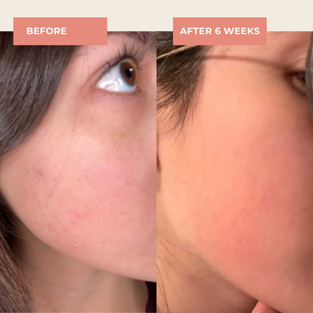 Rosehip Face Oil image 3